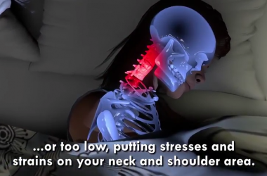 Physiotherapist Animation for Shoulder Neck Pain